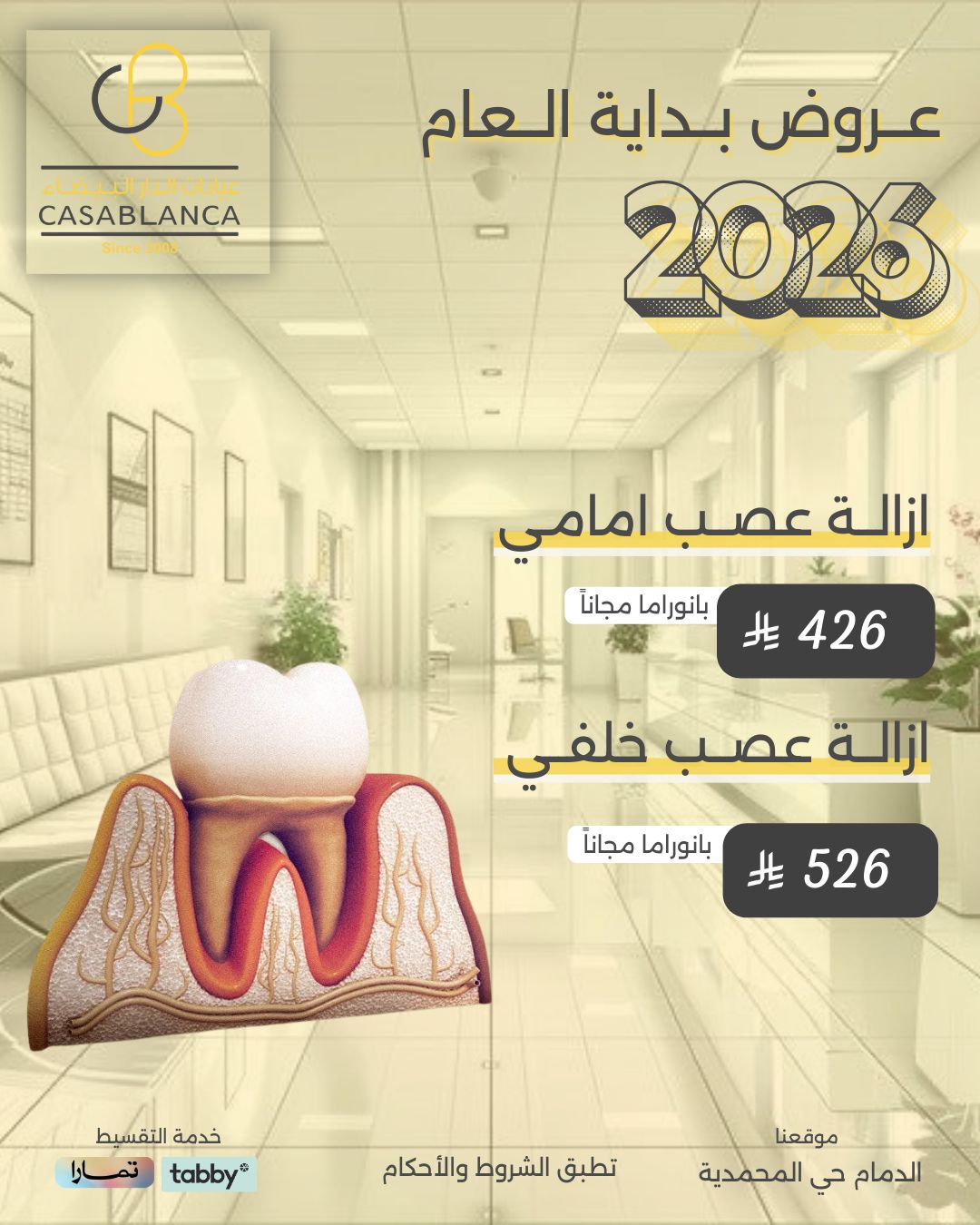 ازالة عصب امامي 426 ريال ازالة عصب خلفي